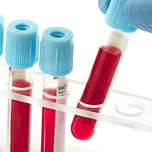 Анализы Analis