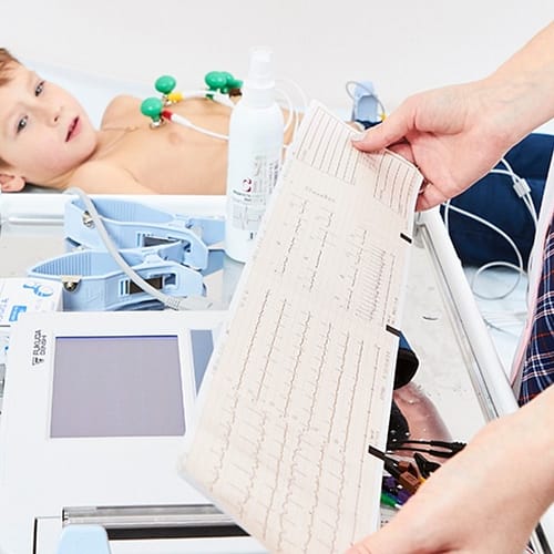 Экг плода Ekg ploda